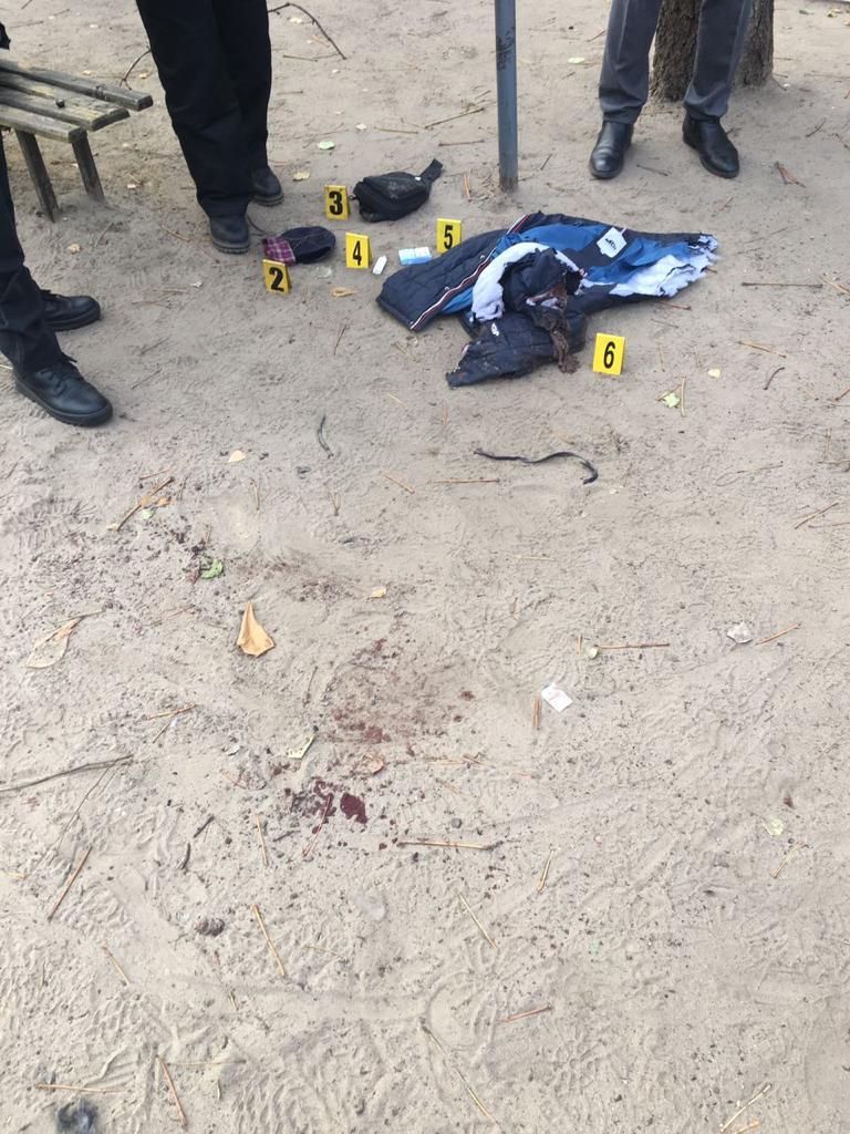 Мужчину, который взорвал гранату на детской площадке в Харькове и лишился руки, арестовали. Фото: facebook.com/prokuraturakharkiv